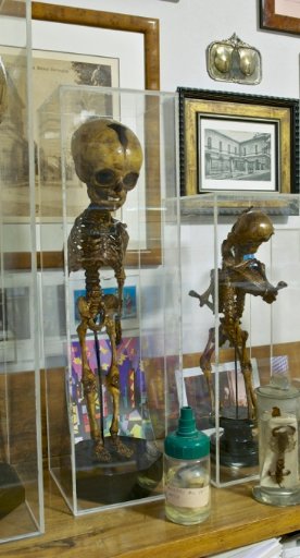 Museo de Anatomía Patológica en Pisa